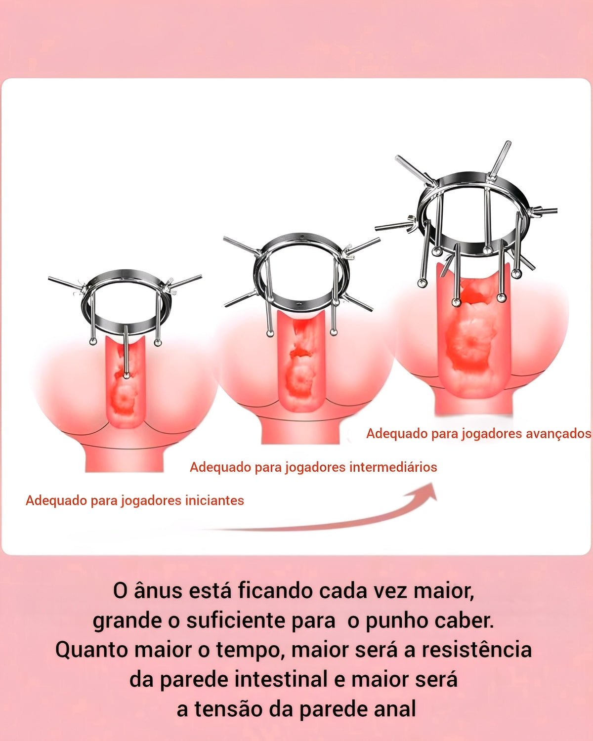 Dilatador Anal e Vaginal Ajustável em Aço Inoxidável - Expansor BDSM de Metal